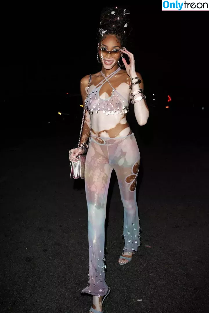 Winnie Harlow nude photo #0238 (winnieharlow)