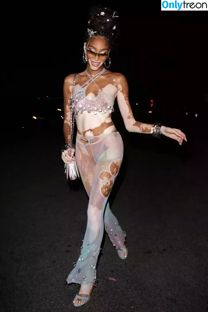 Winnie Harlow nude photo #0239 (winnieharlow)
