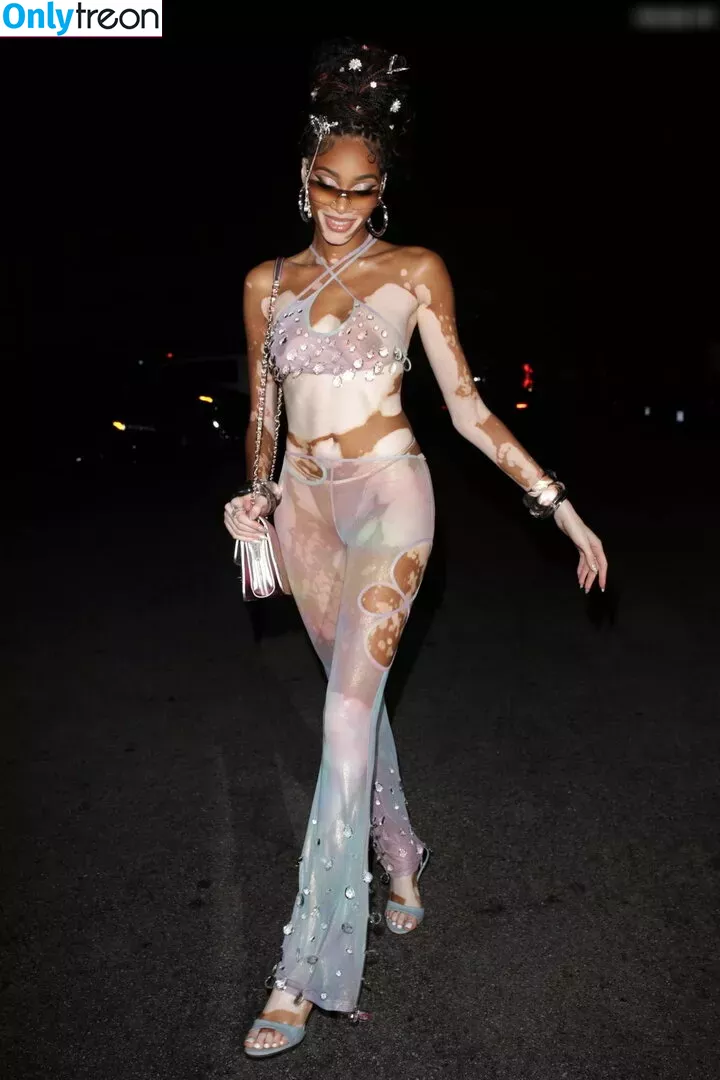 Winnie Harlow nude photo #0241 (winnieharlow)