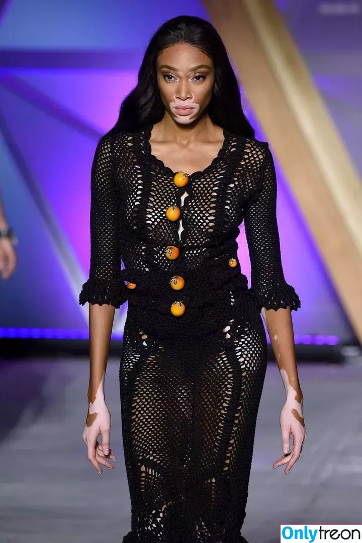 Winnie Harlow nude photo #0245 (winnieharlow)