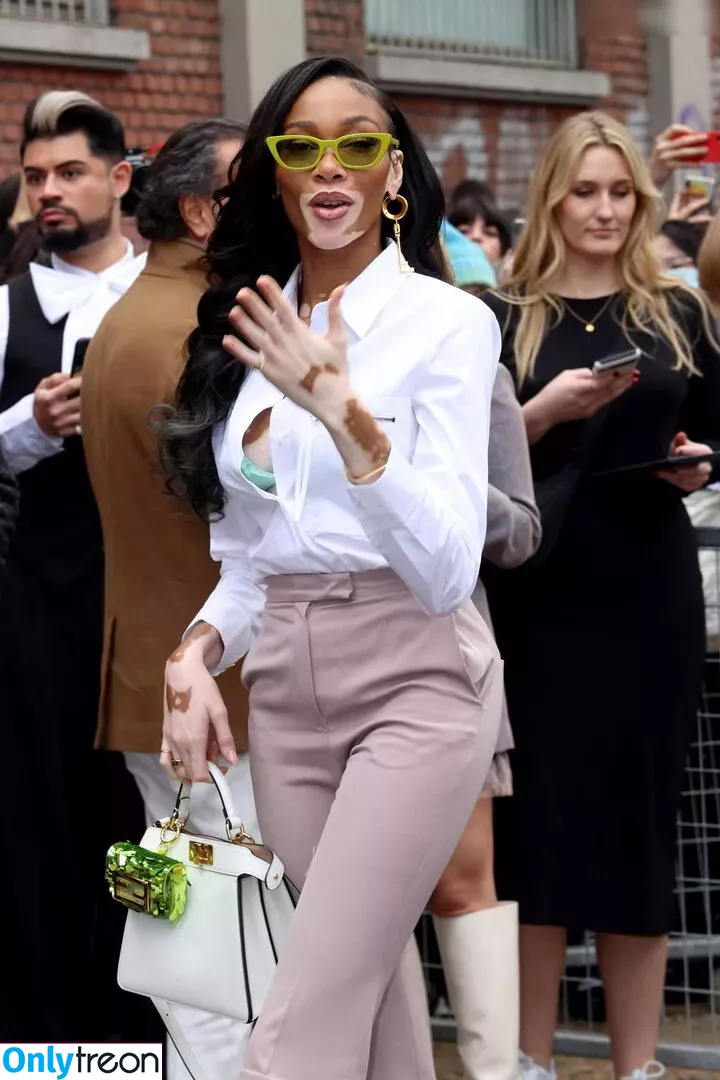 Winnie Harlow nude photo #0255 (winnieharlow)