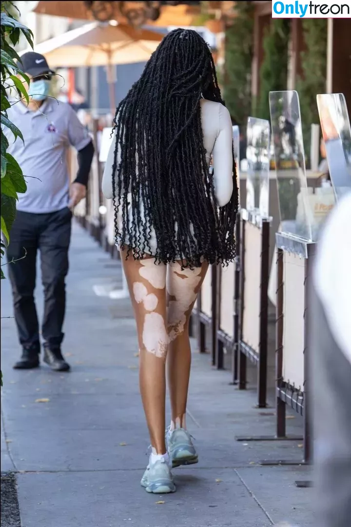 Winnie Harlow nude photo #0269 (winnieharlow)