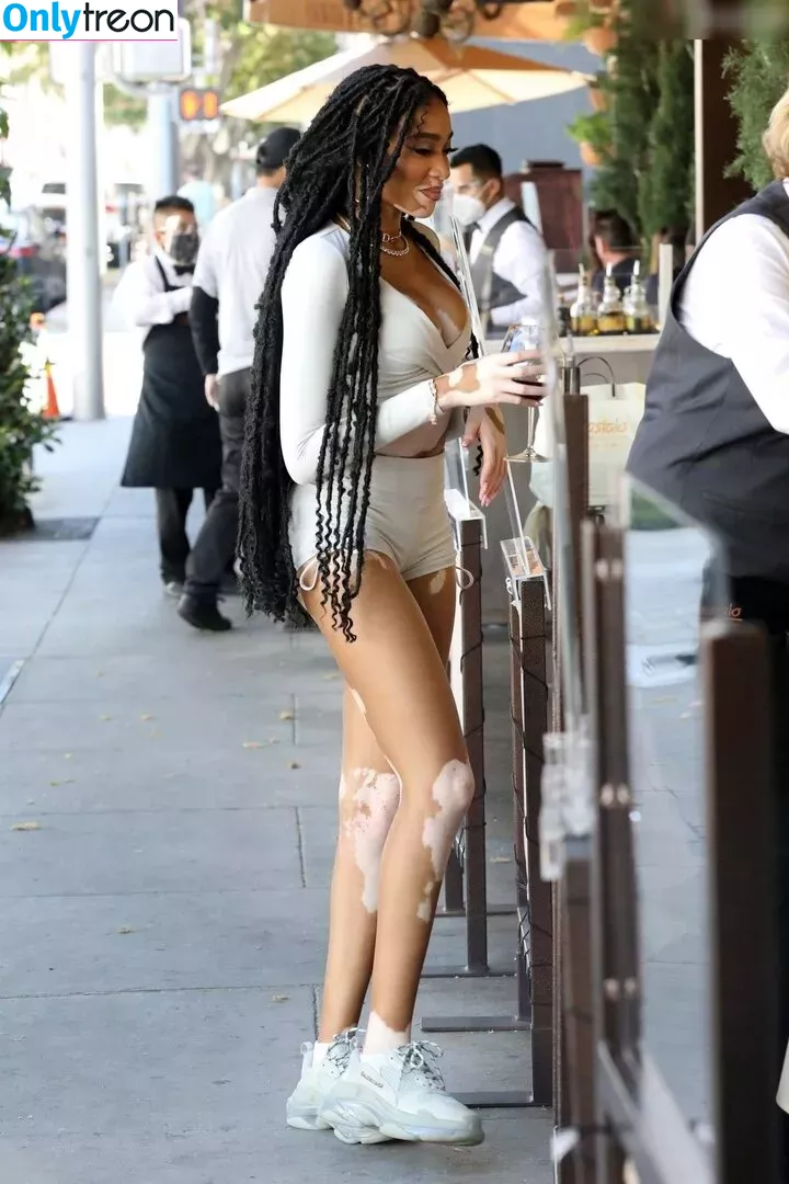 Winnie Harlow nude photo #0273 (winnieharlow)