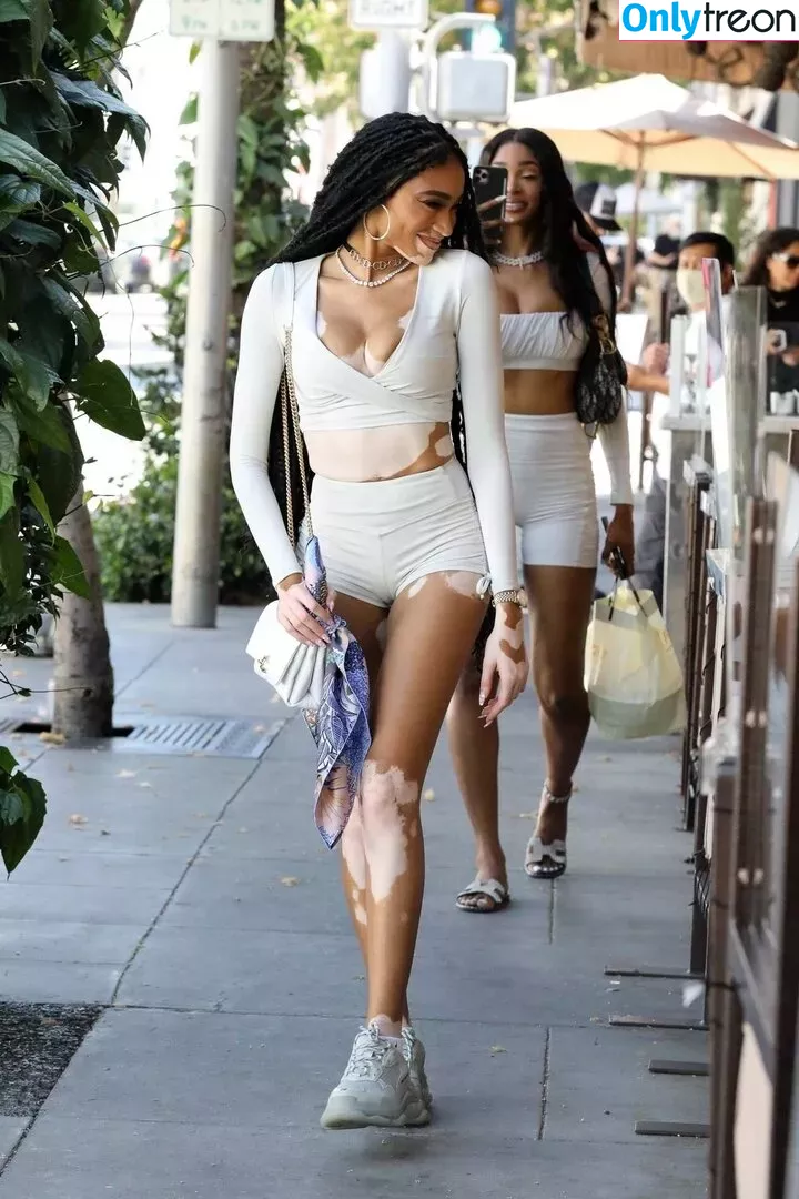 Winnie Harlow nude photo #0278 (winnieharlow)