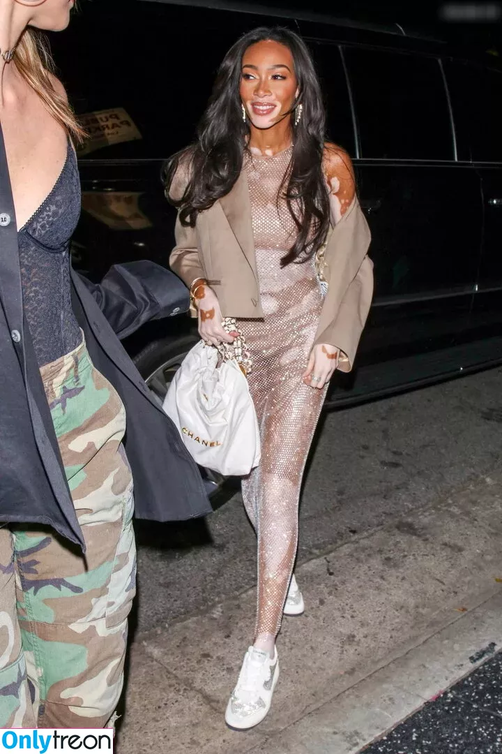Winnie Harlow nude photo #0304 (winnieharlow)