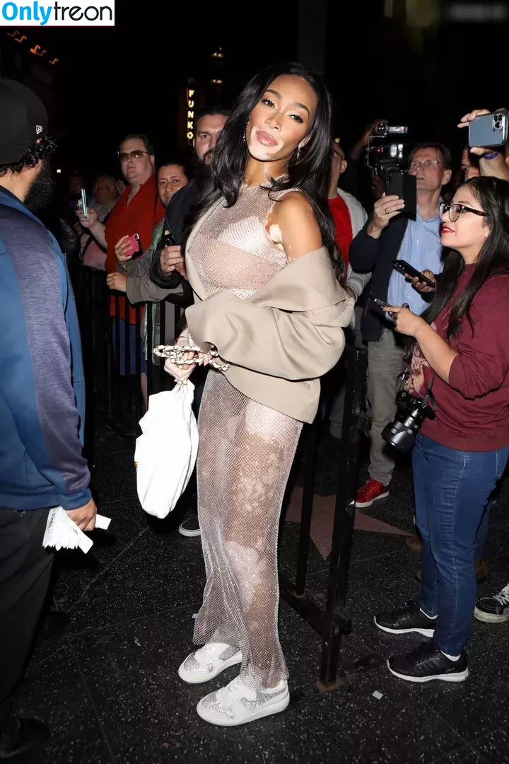 Winnie Harlow nude photo #0306 (winnieharlow)
