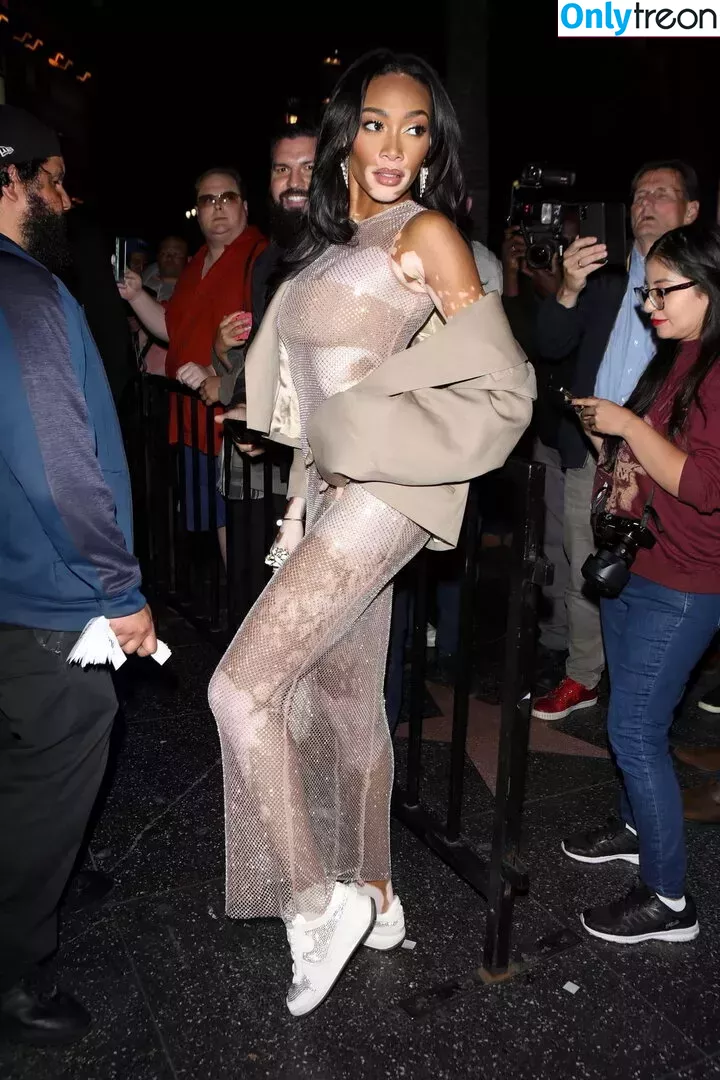 Winnie Harlow nude photo #0308 (winnieharlow)