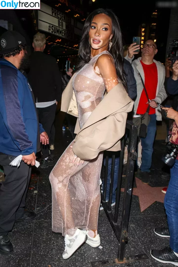 Winnie Harlow nude photo #0309 (winnieharlow)