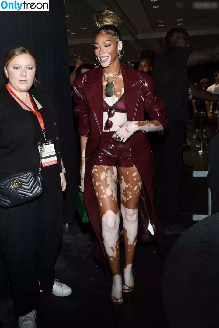 Winnie Harlow nude photo #0312 (winnieharlow)