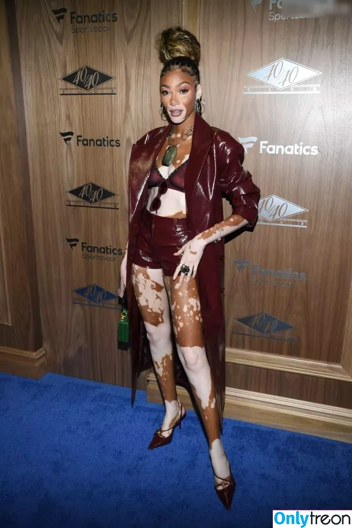 Winnie Harlow nude photo #0314 (winnieharlow)