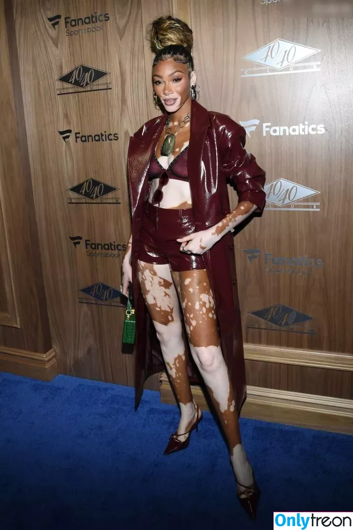 Winnie Harlow nude photo #0318 (winnieharlow)