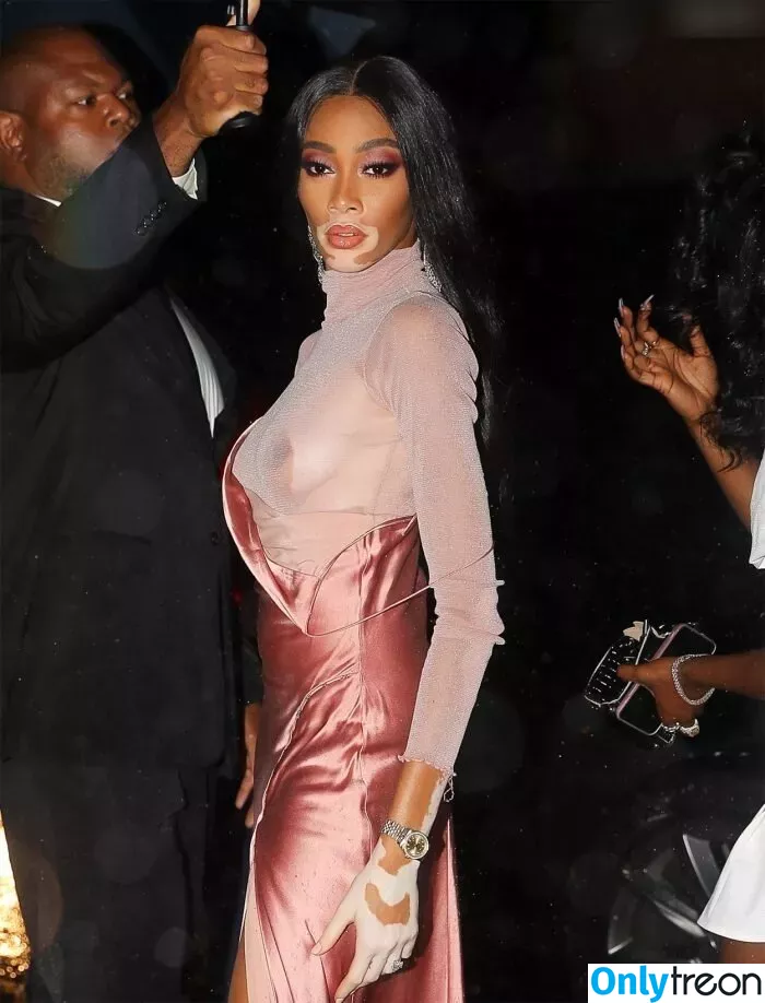 Winnie Harlow nude photo #0321 (winnieharlow)