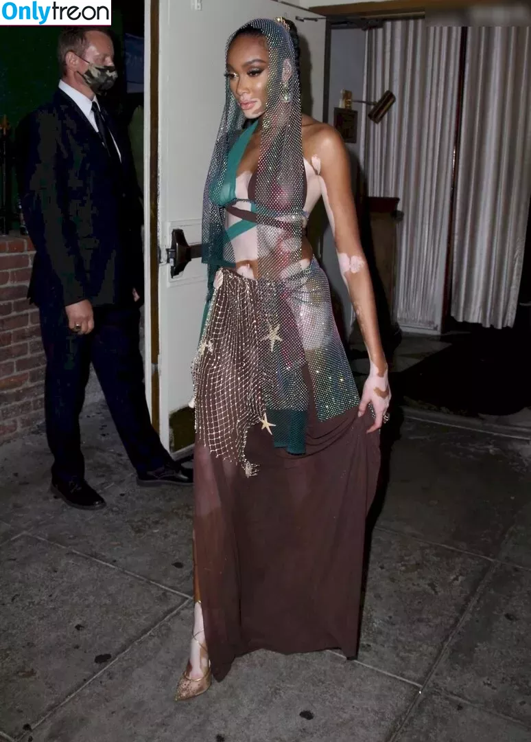 Winnie Harlow nude photo #0323 (winnieharlow)