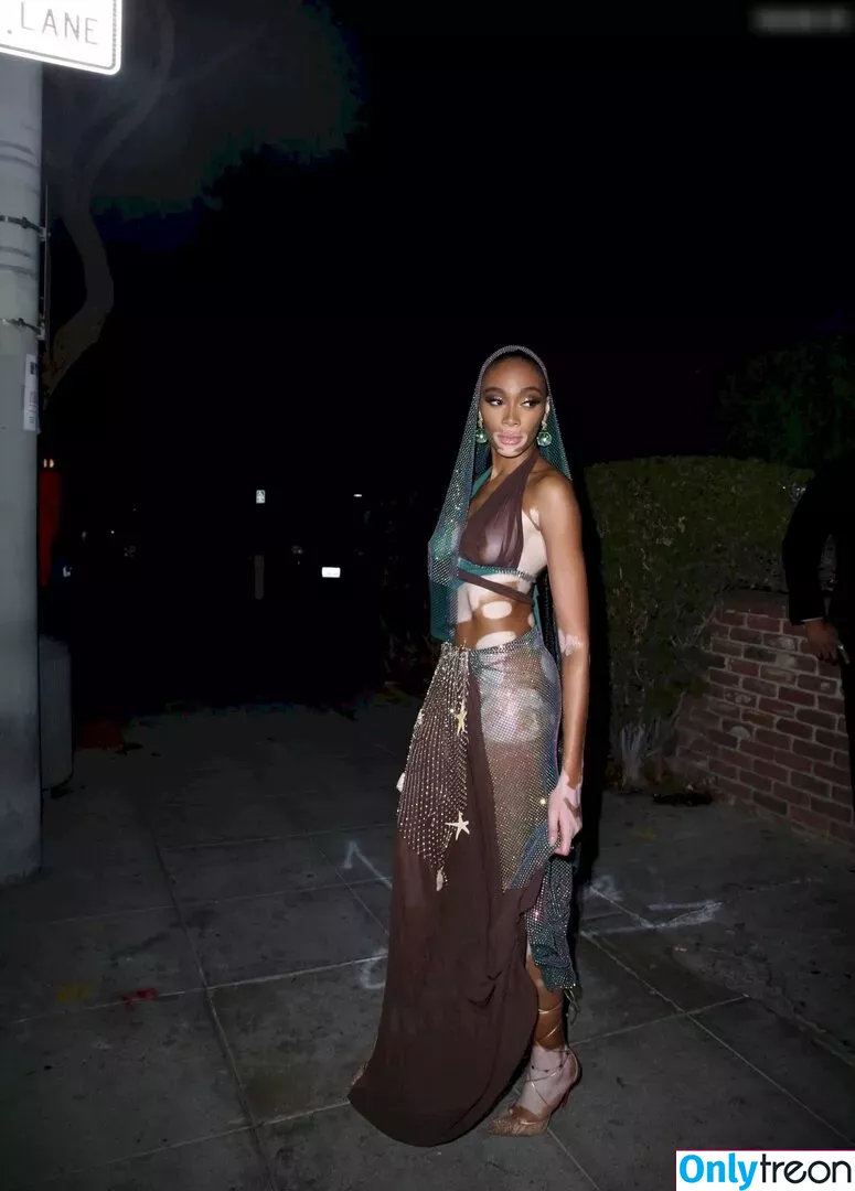 Winnie Harlow nude photo #0324 (winnieharlow)