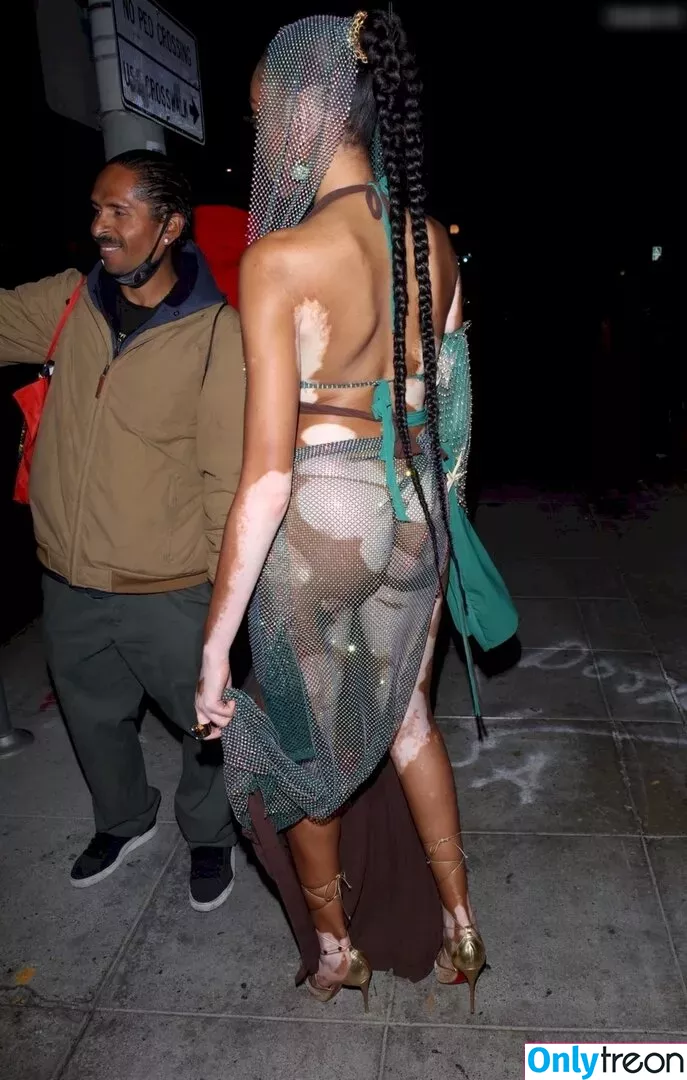 Winnie Harlow nude photo #0325 (winnieharlow)