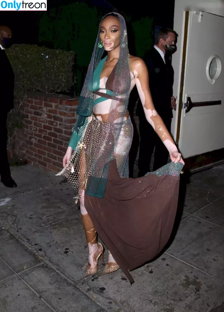 Winnie Harlow nude photo #0328 (winnieharlow)