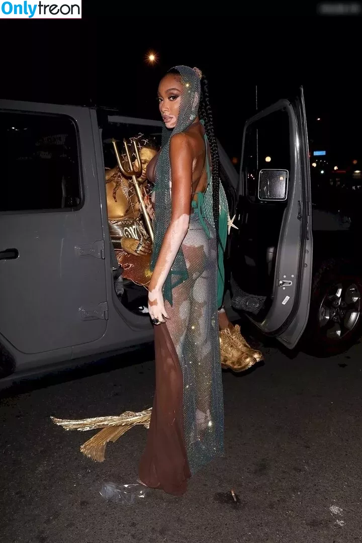 Winnie Harlow nude photo #0330 (winnieharlow)