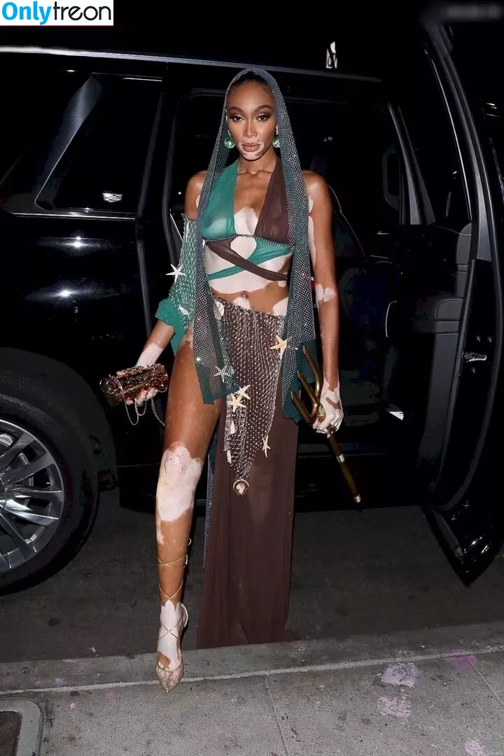 Winnie Harlow nude photo #0331 (winnieharlow)