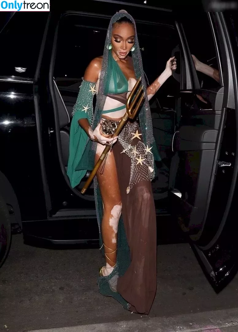 Winnie Harlow nude photo #0333 (winnieharlow)