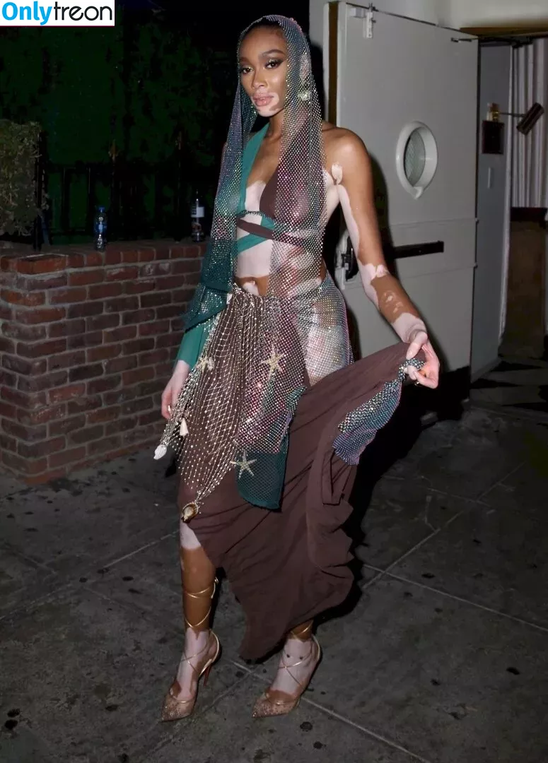 Winnie Harlow nude photo #0334 (winnieharlow)