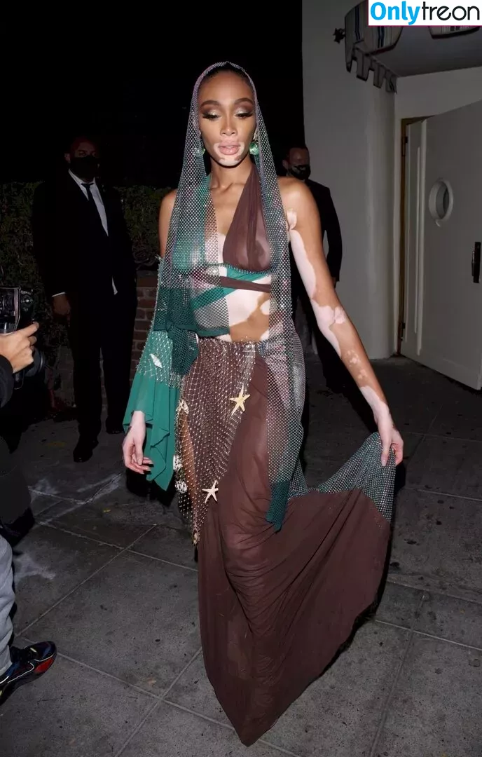 Winnie Harlow nude photo #0337 (winnieharlow)