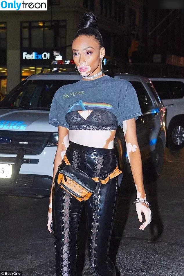 Winnie Harlow nude photo #0339 (winnieharlow)
