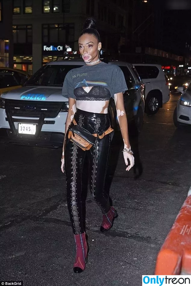 Winnie Harlow nude photo #0342 (winnieharlow)