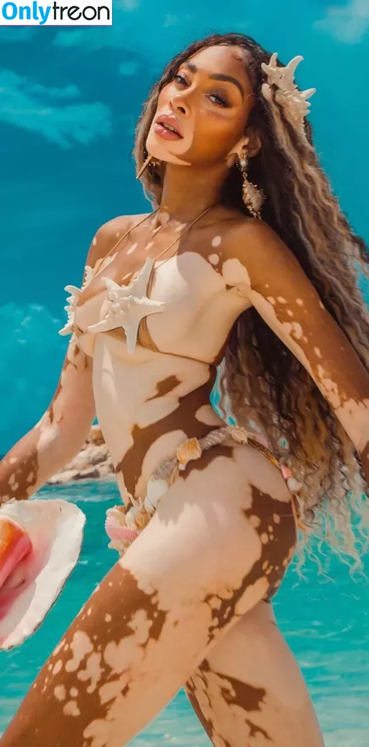 Winnie Harlow nude photo #0344 (winnieharlow)