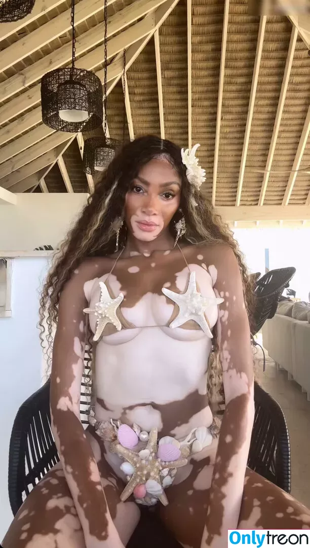 Winnie Harlow nude photo #0345 (winnieharlow)