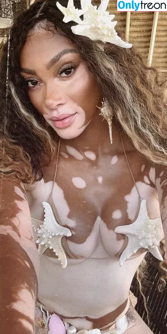 Winnie Harlow nude photo #0346 (winnieharlow)