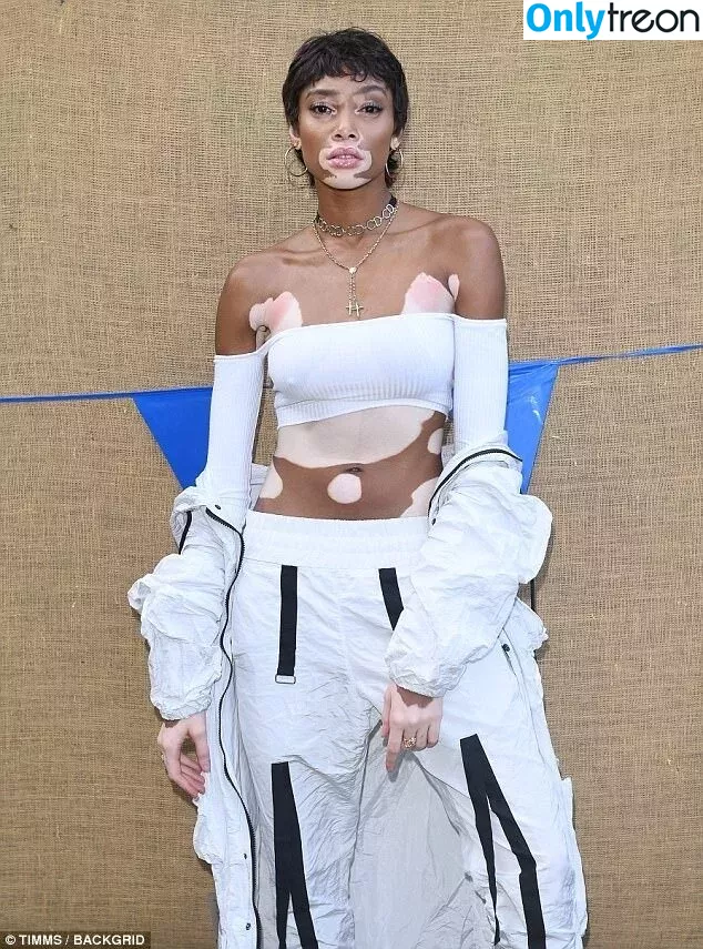 Winnie Harlow nude photo #0349 (winnieharlow)