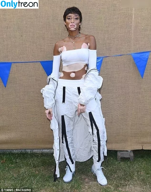 Winnie Harlow nude photo #0352 (winnieharlow)