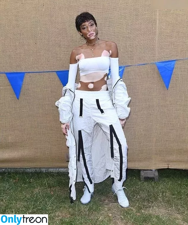 Winnie Harlow голая photo #0353 (winnieharlow)