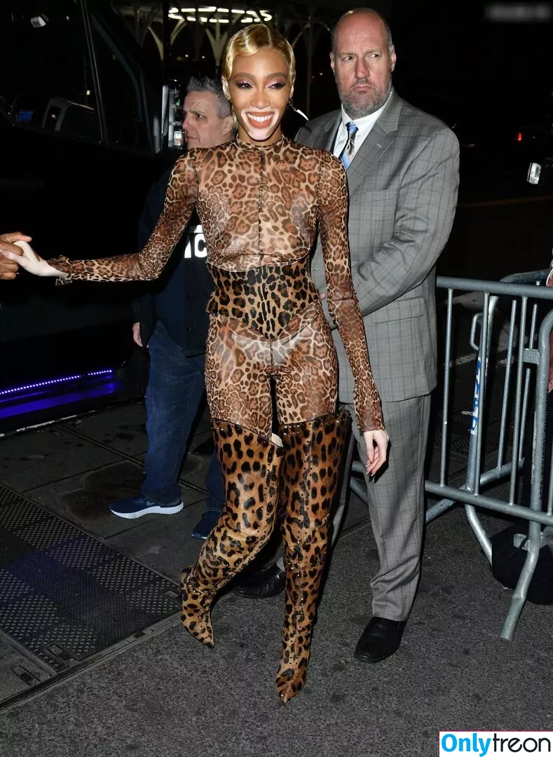 Winnie Harlow nude photo #0357 (winnieharlow)