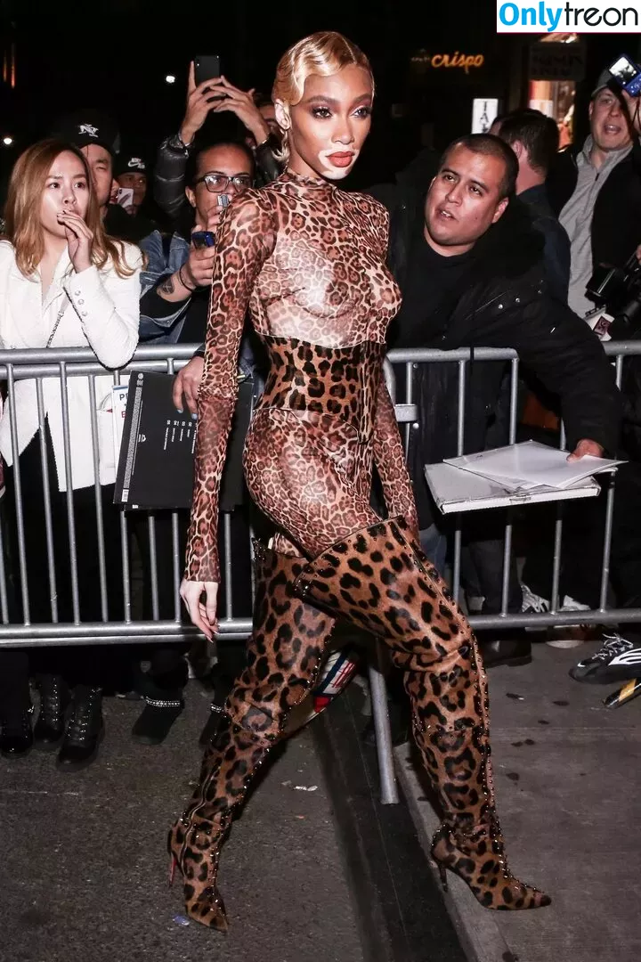 Winnie Harlow nude photo #0360 (winnieharlow)