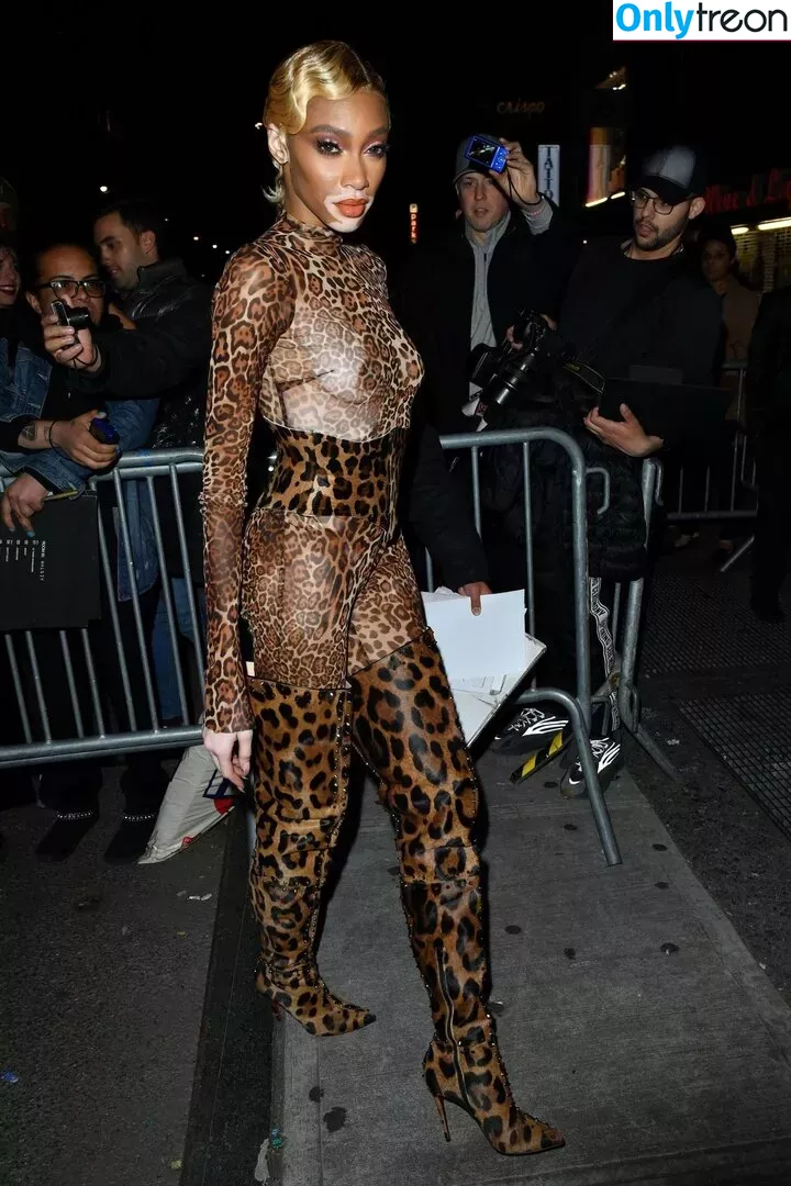 Winnie Harlow nude photo #0361 (winnieharlow)