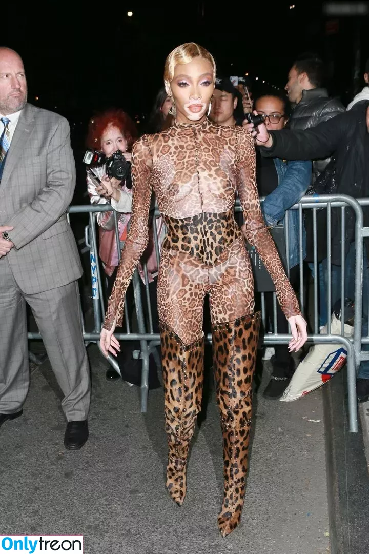 Winnie Harlow nude photo #0363 (winnieharlow)
