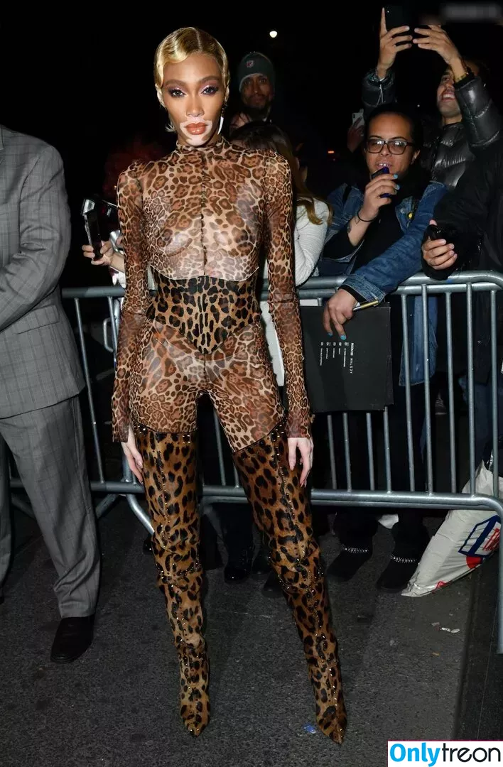 Winnie Harlow nude photo #0364 (winnieharlow)