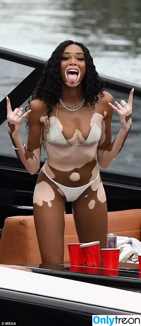 Winnie Harlow nude photo #0371 (winnieharlow)