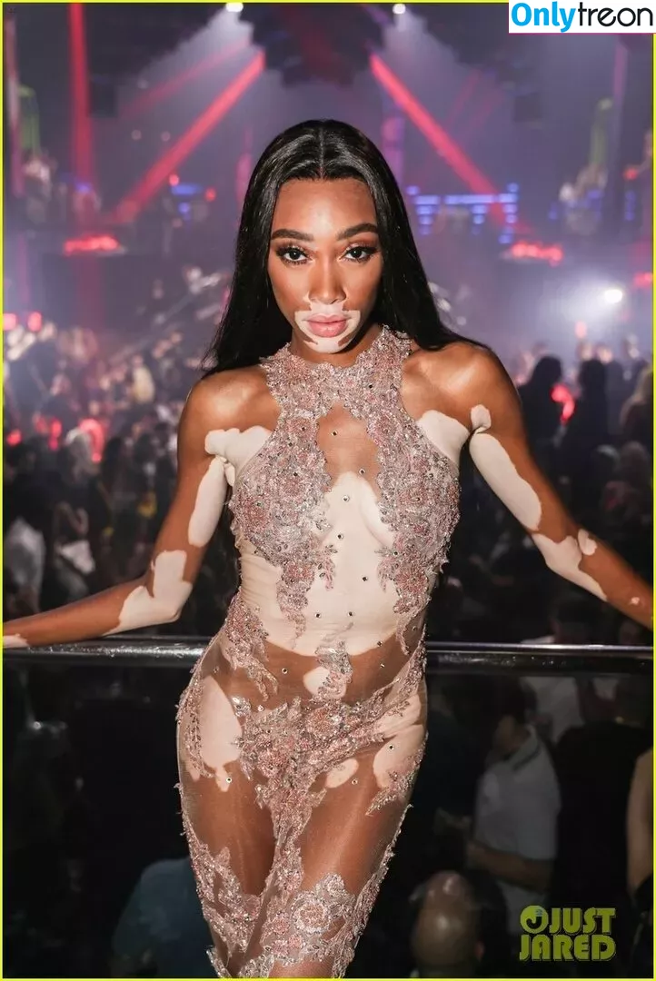 Winnie Harlow nude photo #0372 (winnieharlow)