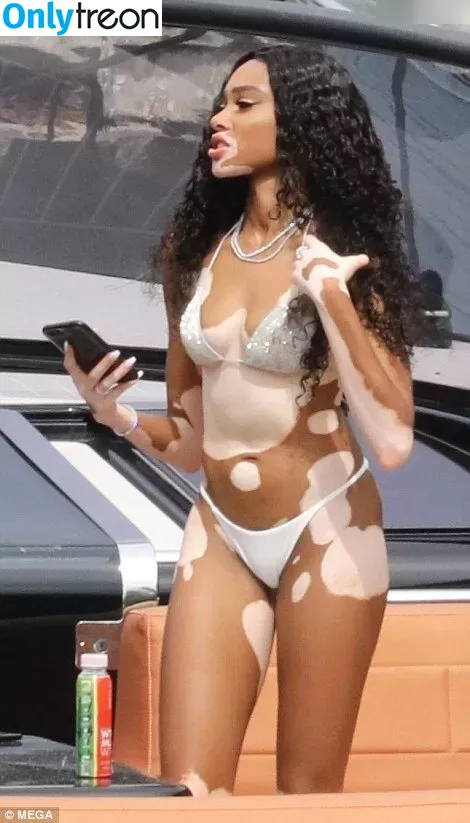 Winnie Harlow nude photo #0373 (winnieharlow)