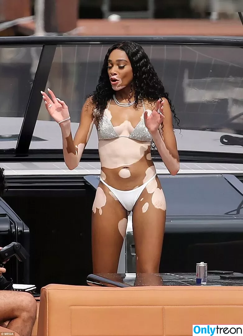 Winnie Harlow nude photo #0375 (winnieharlow)