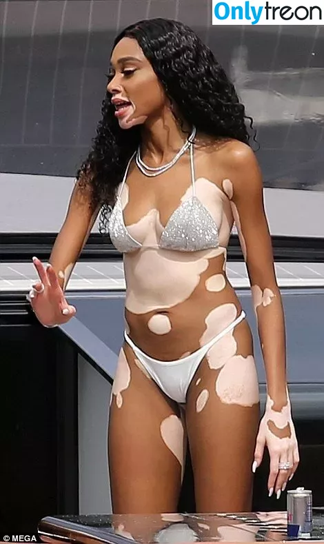 Winnie Harlow nude photo #0376 (winnieharlow)