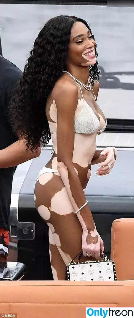 Winnie Harlow nude photo #0378 (winnieharlow)