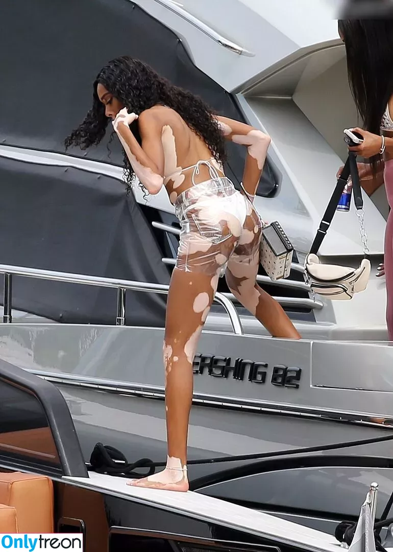 Winnie Harlow nude photo #0379 (winnieharlow)