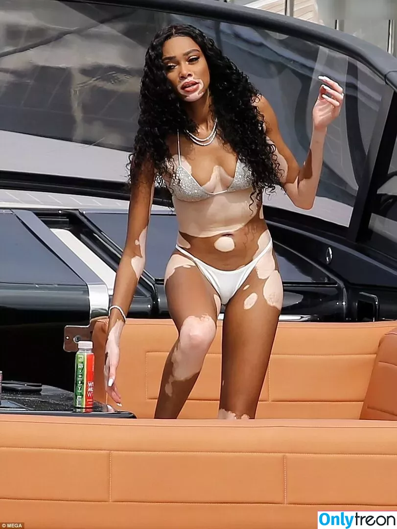 Winnie Harlow nude photo #0380 (winnieharlow)