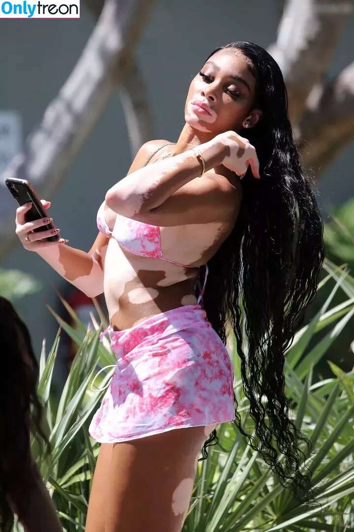 Winnie Harlow nude photo #0398 (winnieharlow)