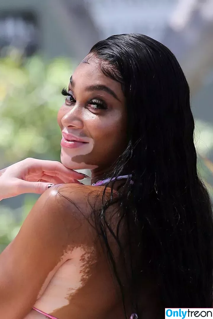 Winnie Harlow nude photo #0402 (winnieharlow)