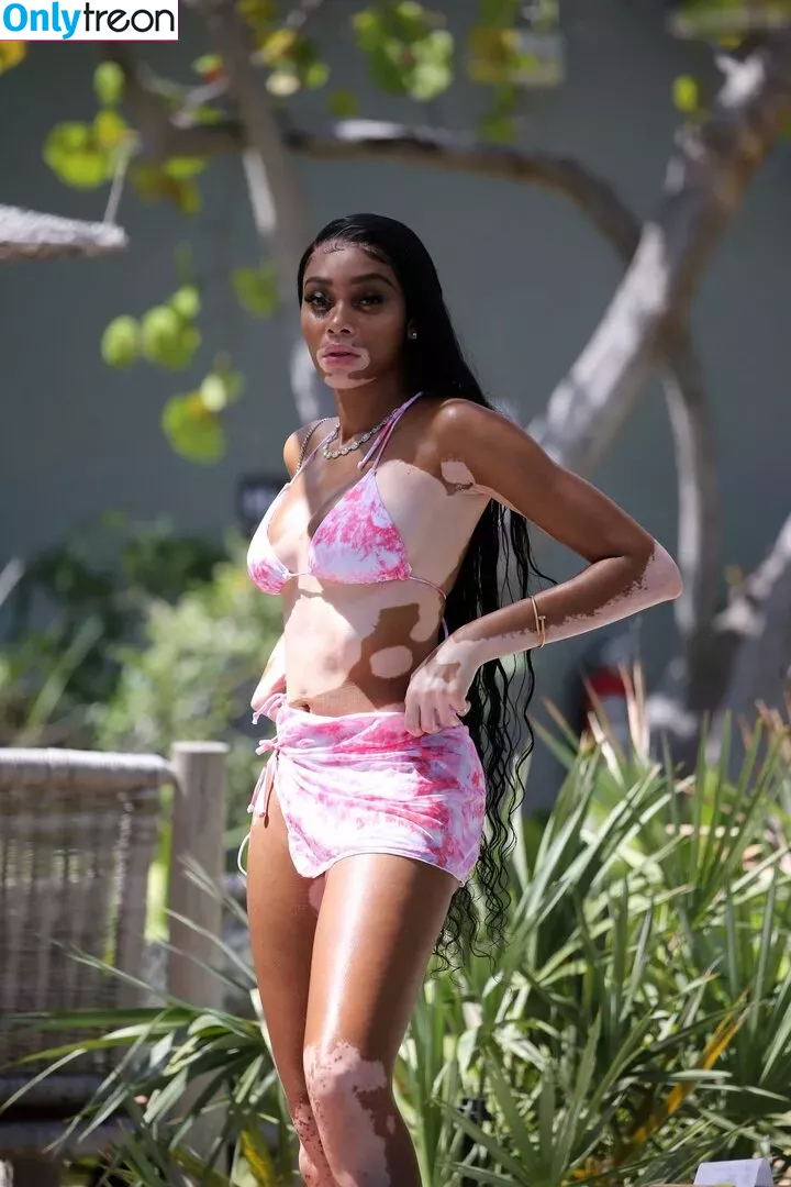 Winnie Harlow nude photo #0406 (winnieharlow)
