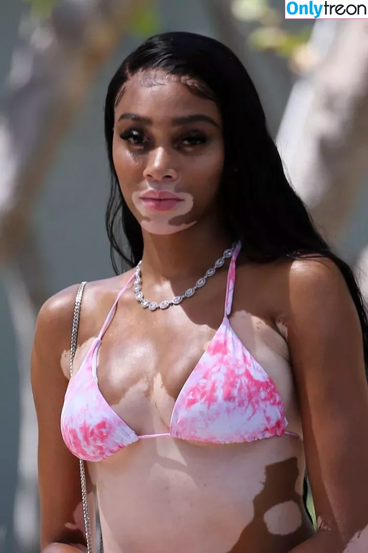 Winnie Harlow nude photo #0413 (winnieharlow)